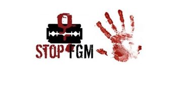 FGM 1